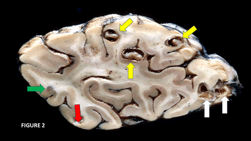 Journa-Drug-Alcohol-Research-Sagittal