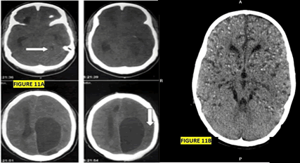 Journal-Drug-Alcohol-Research-Axial-CT