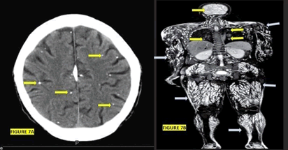 Journal-Drug-Alcohol-Research-Brain