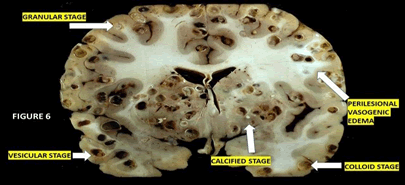 Journal-Drug-Alcohol-Research-Coronal