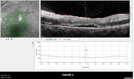 Journal-Drug-Alcohol-Research-MRI